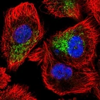 Immunofluorescent staining of human cell line PC-3 shows localization to mitochondria.