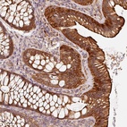 Anti-CEP95 Antibody