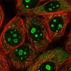 Anti-PARP10 Antibody