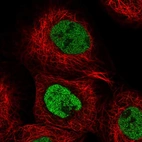 Immunofluorescent staining of human cell line A-431 shows localization to nucleoplasm.