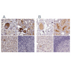 Anti-AFM Antibody