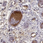 Immunohistochemical staining of human colon using Anti-AFM antibody HPA052437.