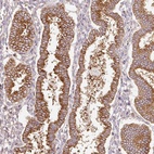 Anti-SCNM1 Antibody