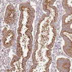 Anti-SCNM1 Antibody