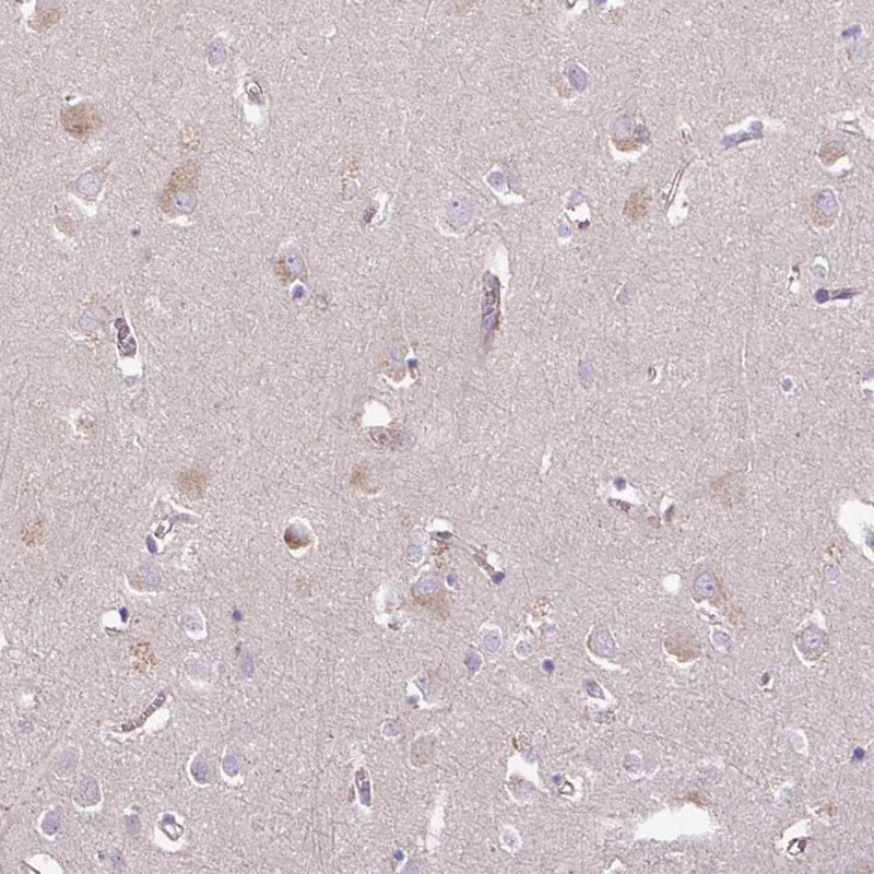 Anti-C4orf48 Antibody