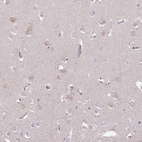 Anti-C4orf48 Antibody