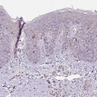 Immunohistochemical staining of human skin shows moderate cytoplasmic positivity in Langerhans cells.