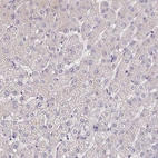 Immunohistochemical staining of human liver shows no positivity in hepatocytes as expected.