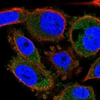 Immunofluorescent staining of human cell line PC-3 shows localization to cytosol.