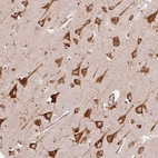 Anti-KLC1 Antibody
