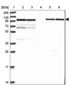 Lane 1: Marker [kDa] 250, 130, 95, 72, 55, 36, 28, 17, 10_br/_Lane 2: Human cell line RT-4_br/_Lane 3: Human cell line U-251MG sp_br/_Lane 4: Human plasma (IgG/HSA depleted)_br/_Lane 5: Human liver tissue_br/_Lane 6: Human tonsil tissue