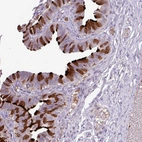 Immunohistochemical staining of human fallopian tube shows high expression.