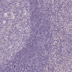 Anti-DNAJB13 Antibody