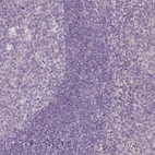 Immunohistochemical staining of human tonsil shows low expression as expected.