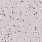 Anti-MAP1LC3A Antibody