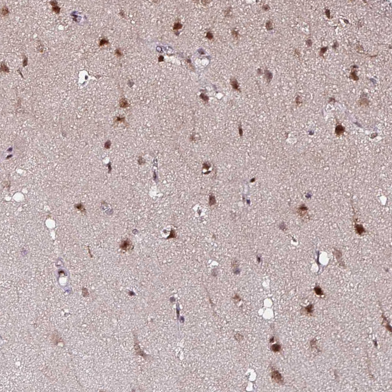 Anti-KLF16 Antibody
