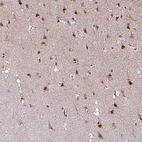 Anti-KLF16 Antibody