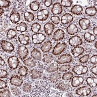 Immunohistochemical staining of human small intestine shows strong nuclear positivity in glandular cells.