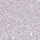 Immunohistochemical staining of human liver shows very weak nuclear positivity in hepatocytes.