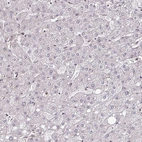 Immunohistochemical staining of human liver shows very weak nuclear positivity in hepatocytes.