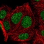 Immunofluorescent staining of human cell line MCF7 shows localization to nucleus.