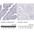 Anti-LDLRAD1 Antibody