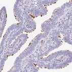 Immunohistochemical staining of human fallopian tube shows high expression.