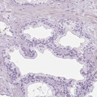 Immunohistochemical staining of human prostate shows no positivity in glandular cells as expected.