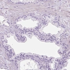 Immunohistochemical staining of human prostate shows no positivity in glandular cells as expected.