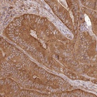 Anti-GSPT1 Antibody