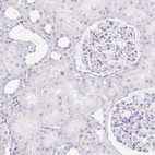 Immunohistochemical staining of human kidney shows low expression as expected.