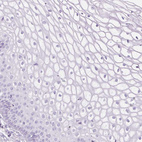 Immunohistochemical staining of human cervix, uterine shows no positivity in squamous epithelial cells as expected.