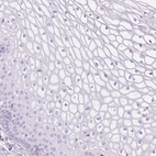 Immunohistochemical staining of human cervix, uterine shows no positivity in squamous epithelial cells as expected.