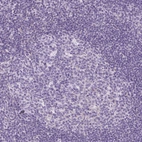 Immunohistochemical staining of human tonsil shows no positivity in germinal center cells as expected.