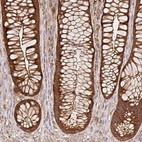 Immunohistochemical staining of human rectum shows strong cytoplasmic positivity in glandular cells.