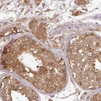 Immunohistochemical staining of human testis shows moderate cytoplasmic positivity in cells in seminiferous ducts and Leydig cells.