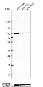 Western blot analysis in EFO-21 cells transfected with control siRNA, target specific siRNA probe #1 and #2, using Anti-GSPT1 antibody. Remaining relative intensity is presented. Loading control: Anti-PARP1.