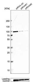 Western blot analysis in EFO-21 cells transfected with control siRNA, target specific siRNA probe #1 and #2, using Anti-GSPT1 antibody. Remaining relative intensity is presented. Loading control: Anti-PARP1.