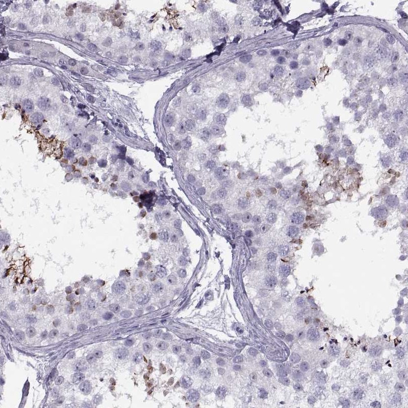 Anti-FAM24B Antibody
