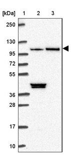 Lane 1: Marker [kDa] 250, 130, 95, 72, 55, 36, 28, 17, 10_br/_Lane 2: Human cell line RT-4_br/_Lane 3: Human cell line U-251MG sp