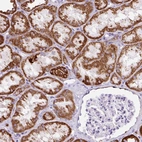 Immunohistochemical staining of human kidney shows strong granular cytoplasmic positivity in cells in tubules.