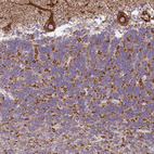 Immunohistochemical staining of human cerebellum shows strong granular cytoplasmic positivity in Purkinje cells.