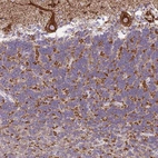Immunohistochemical staining of human cerebellum shows strong granular cytoplasmic positivity in Purkinje cells.