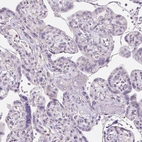 Immunohistochemical staining of human placenta shows no positivity in trophoblastic cells as expected.