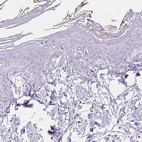 Immunohistochemical staining of human skin shows no positivity in squamous epithelial cells as expected.