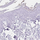 Immunohistochemical staining of human skin shows no positivity in squamous epithelial cells as expected.