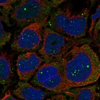 Immunofluorescent staining of human cell line CACO-2 shows localization to nucleoli fibrillar center & cytosol.