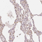 Immunohistochemical staining of human lung shows weak cytoplasmic positivity in macrophages.