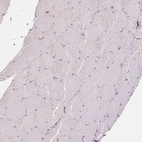 Immunohistochemical staining of human skeletal muscle shows no positivity in myocytes as expected.