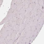 Immunohistochemical staining of human skeletal muscle shows no positivity in myocytes as expected.